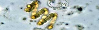 Anabaenaspiroides, microscopic animals