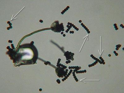 magnified mold spores
