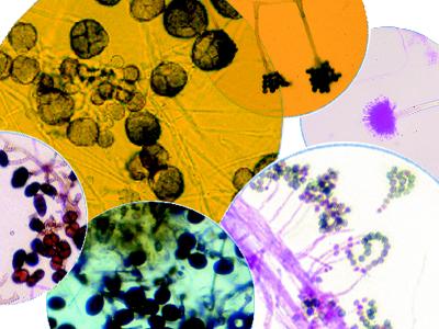 Magnified mold and mold spores
