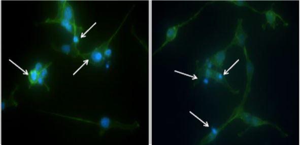 Cell proteins are changes by exposure to nickel, cadmium, and chromium