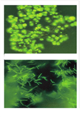 Closeup photos of two kinds of bacteria