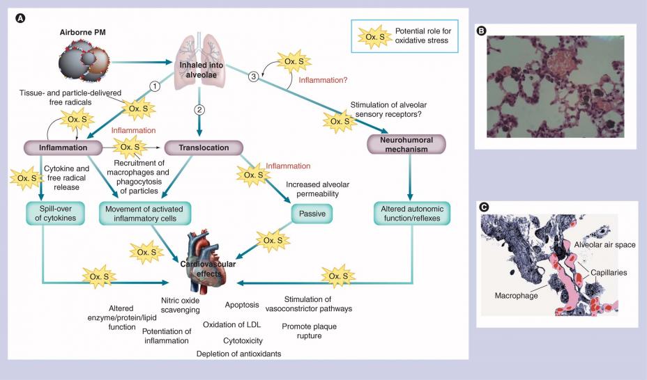 Possible mechanisms for cardiovascular effects from particle pollution