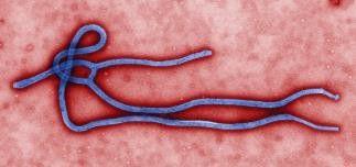 image of ebola virus