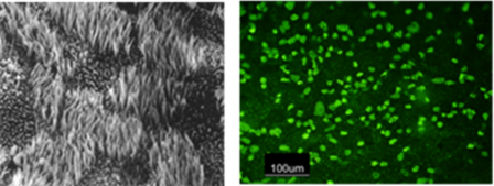 Human bronchial cells with cilia and a second photo of goblet cells