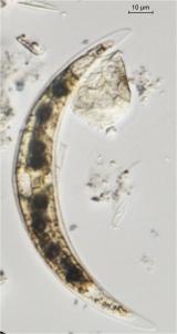 microphoto of a diatom closterium dianae